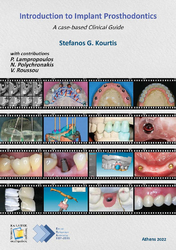 Read more about Introduction to Implant Prosthodontics: A Case-Based Clinical Guide